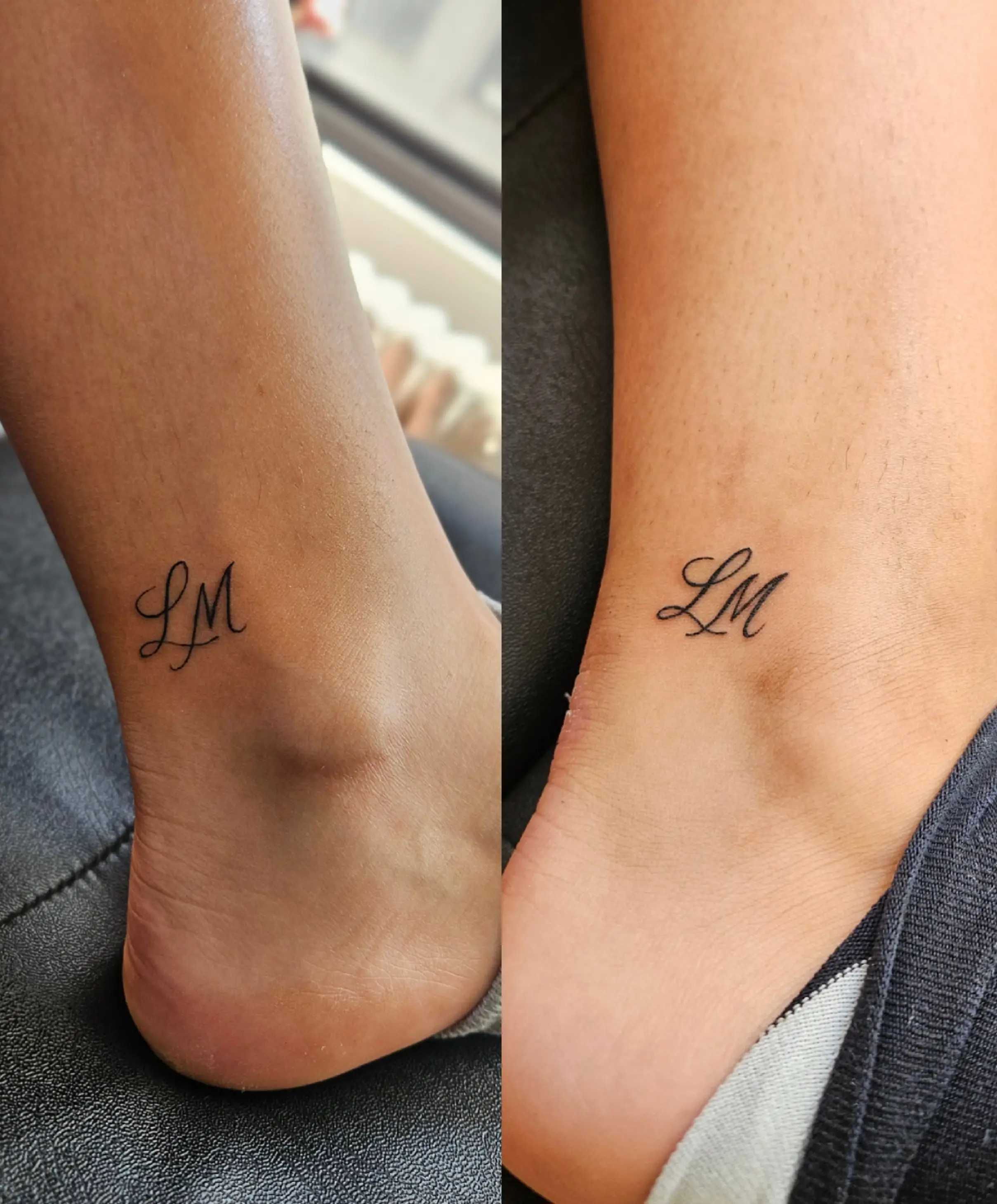 Wrist monogram 'LM'; clean lines, small size, post-healing appearance.